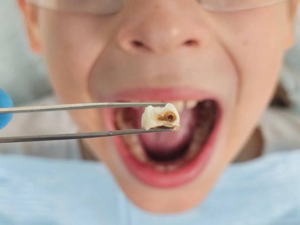 Best Emergency Pediatric Dental Care in Alexander, AR